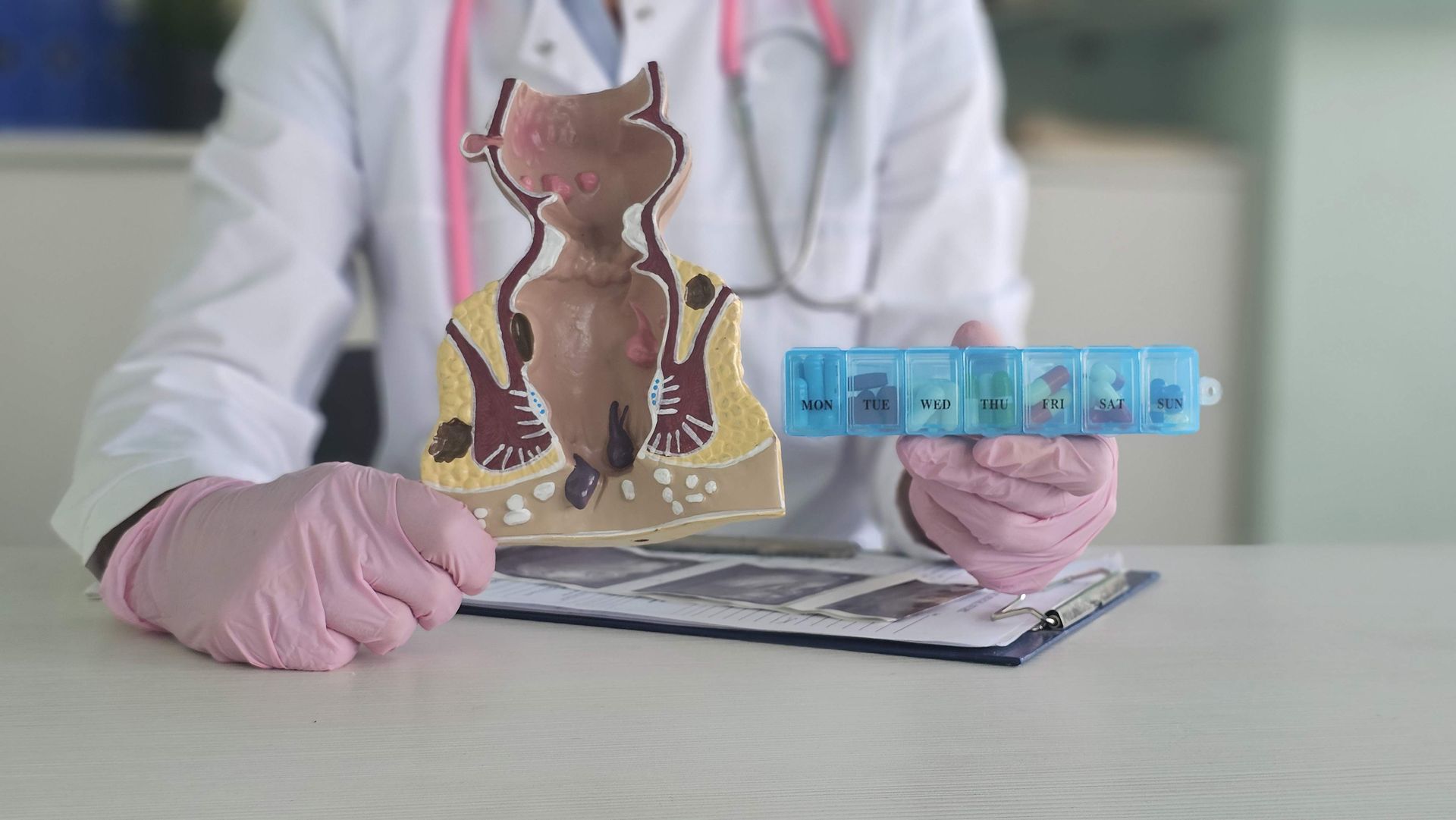 A doctor wearing gloves holding an anatomical rectum model and a blue pill organizer on a desk