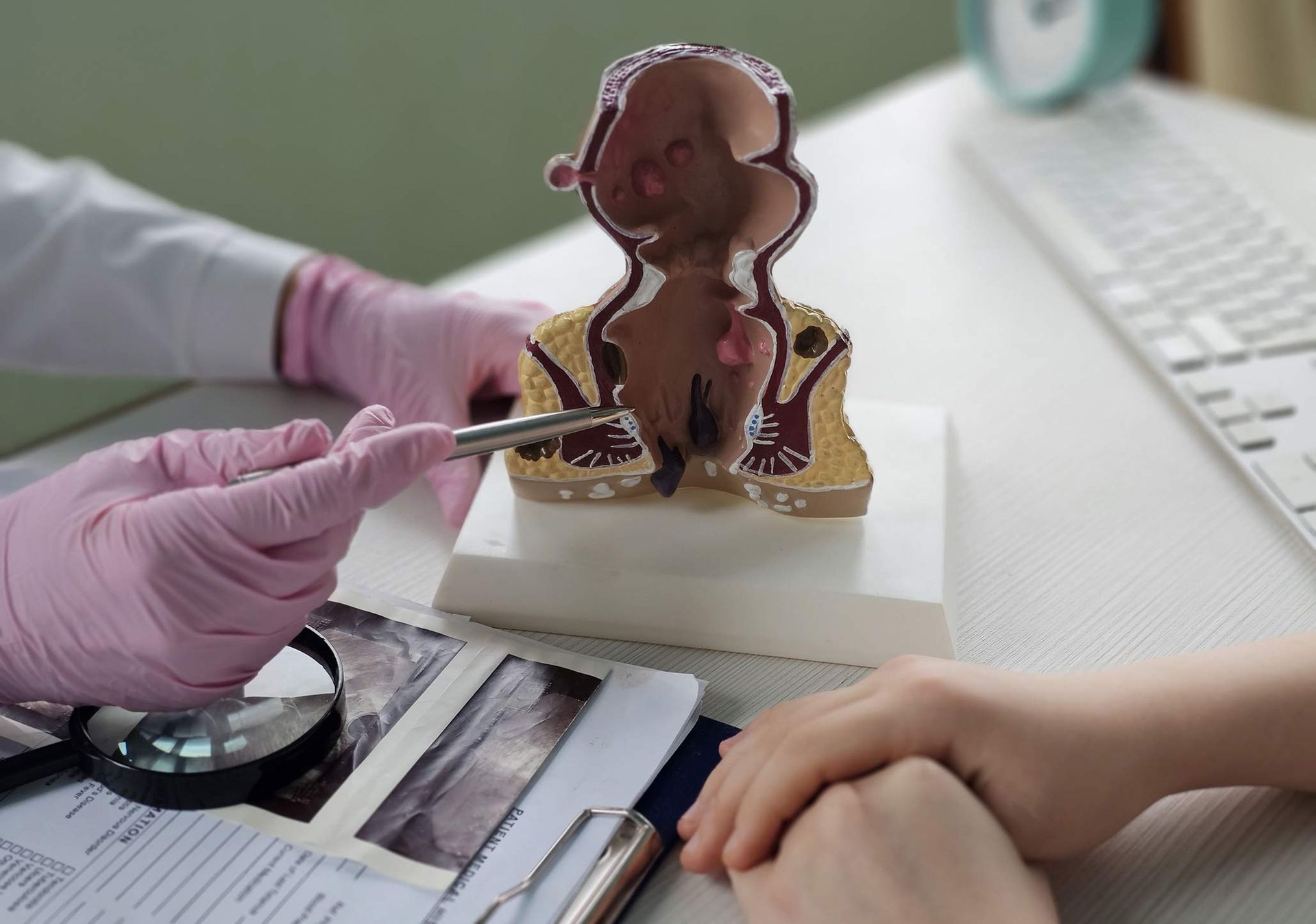 Patient and doctor review rectum anatomy model with hemorrhoids in hospital.