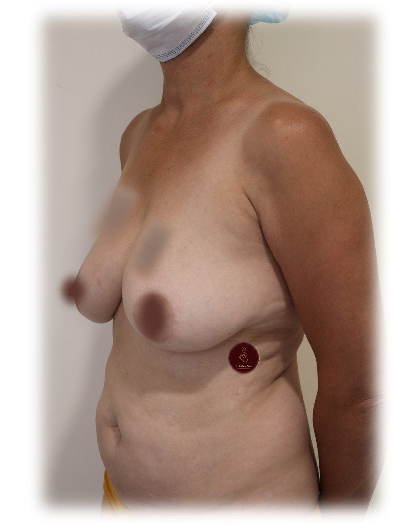 large areolar saggy breasts pancakes droopy tasmania