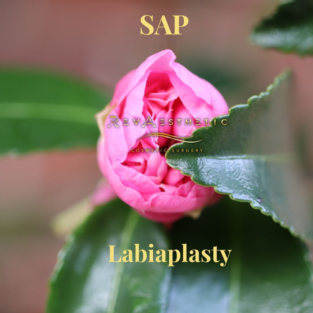 RevAesthetic team performing Sap labiaplasty - selective anatomic preservation labiaplasty in Melbourne pioneered by Dr Nara