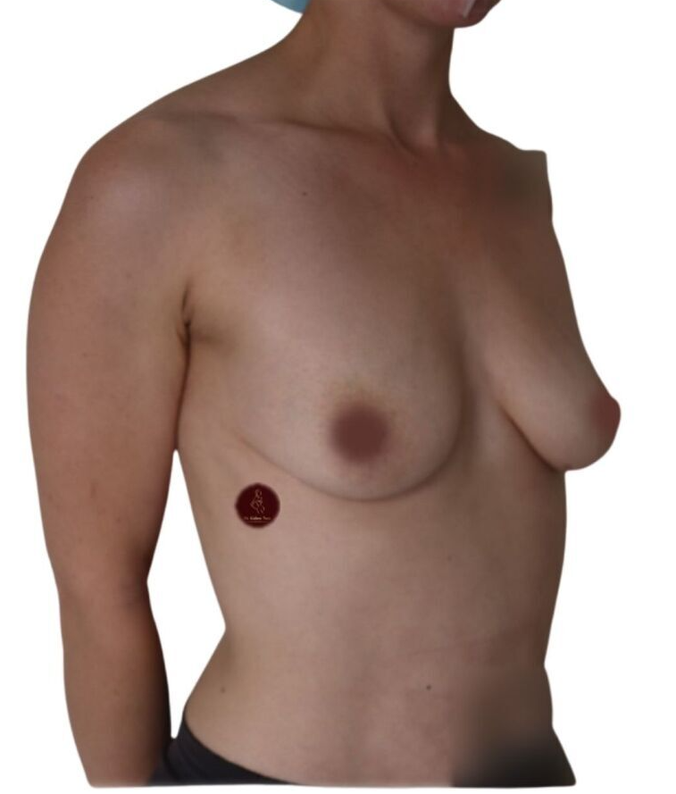 Best boobs top breast augmentation implants
Cosmetic plastic surgeon melbourne tasmania