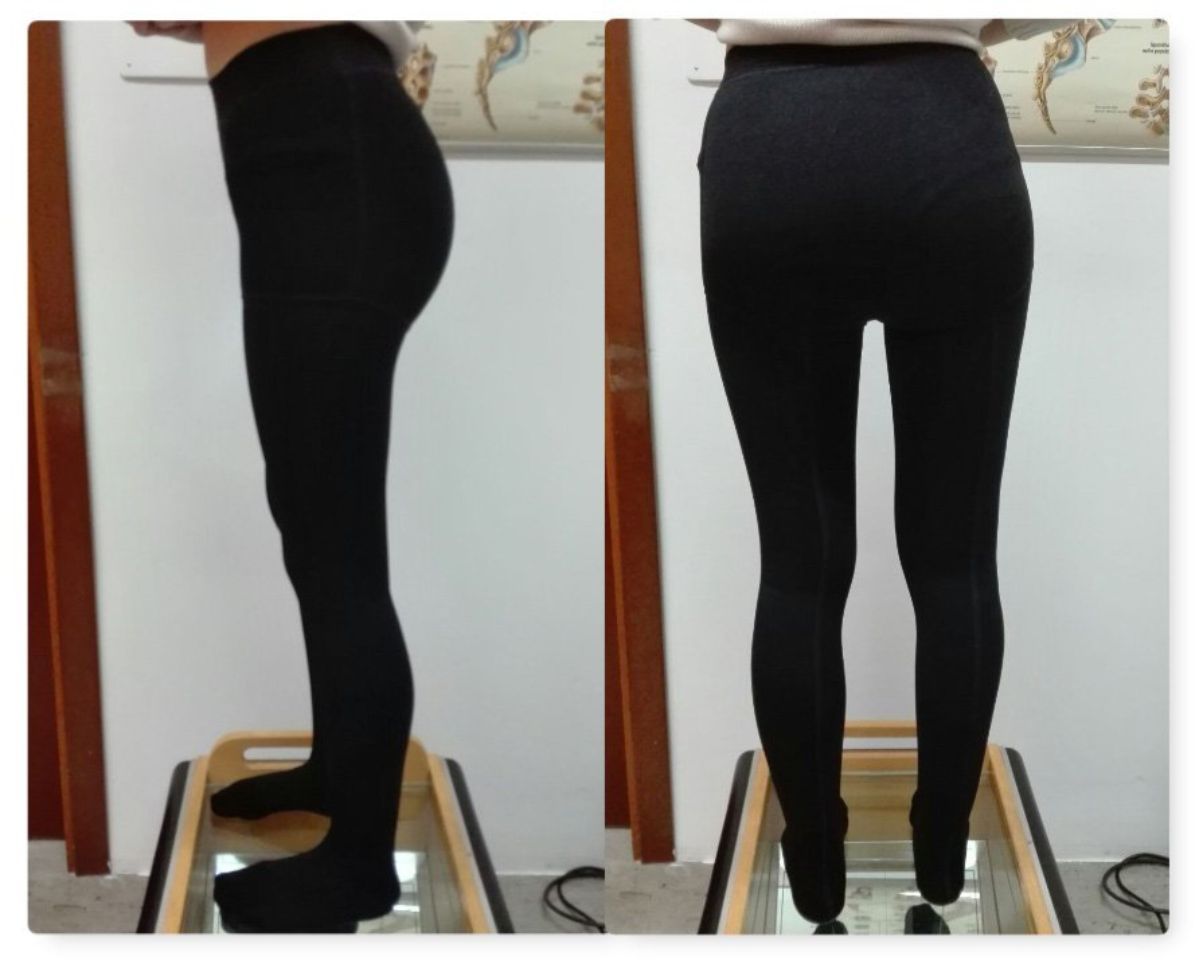 Calze elastocompressive