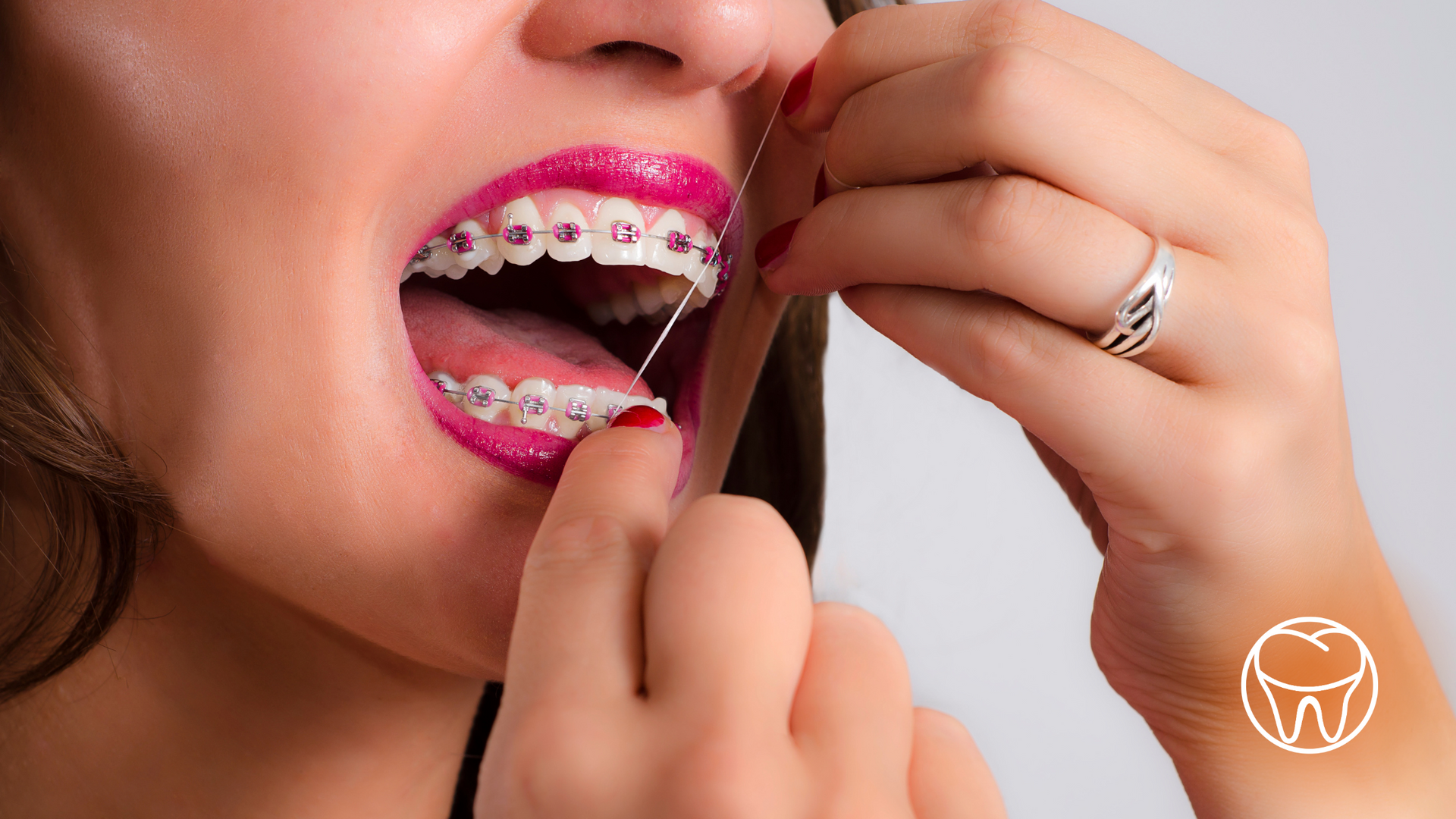 A woman with braces is flossing her teeth with a floss.