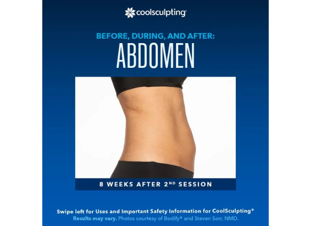 CoolSculpting 3 | Northshore Dermatology