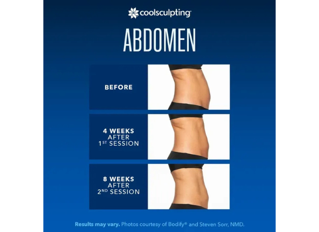 CoolSculpting 4 | Northshore Dermatology