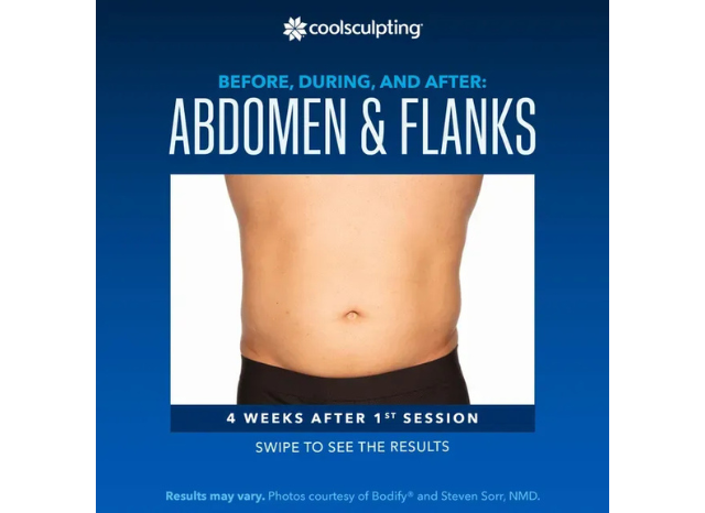 CoolSculpting 10 | Northshore Dermatology