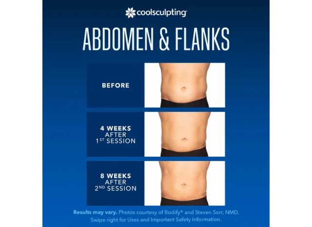 CoolSculpting 12 | Northshore Dermatology