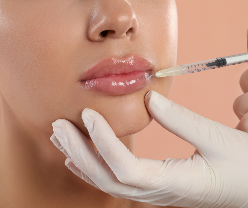 Lip Filler | Northshore Dermatology | Service Page