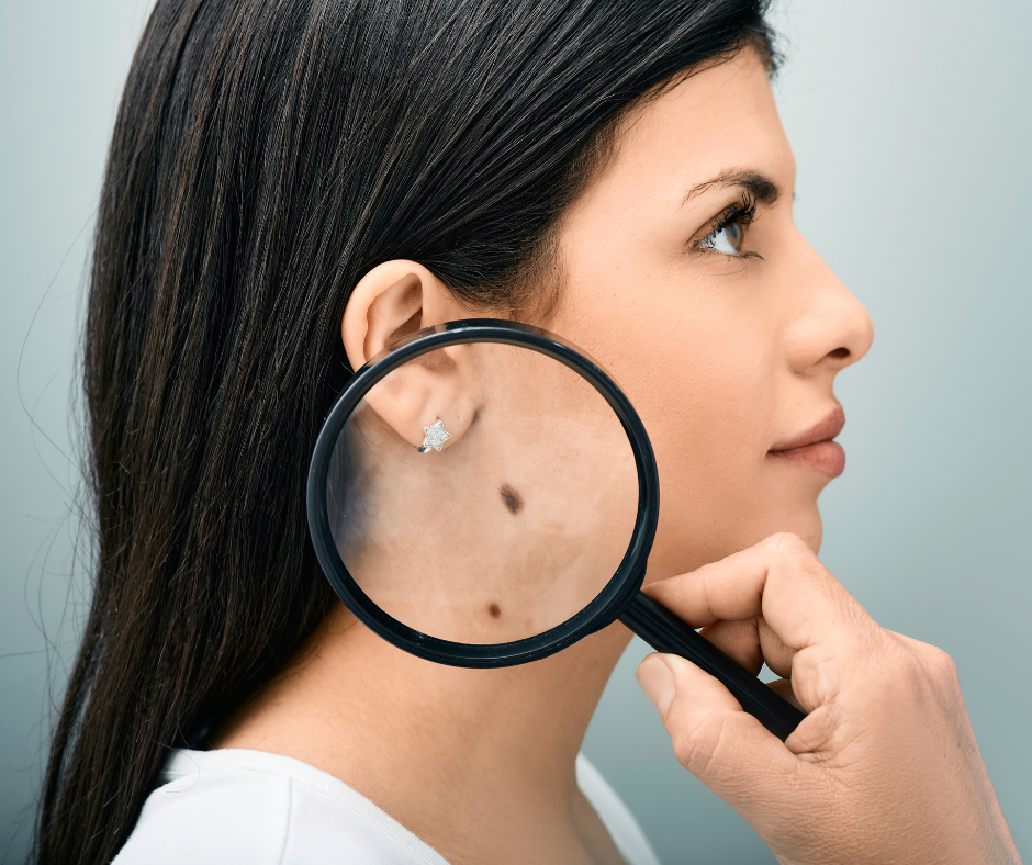 Skin Cancer | Northshore Dermatology | Service Page