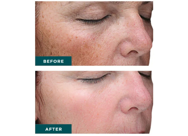 Skin Services | Northshore Dermatology