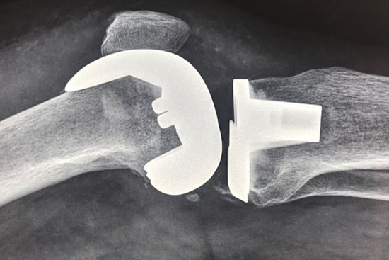 ORTOPEDICO PERA DR. ANTONIO