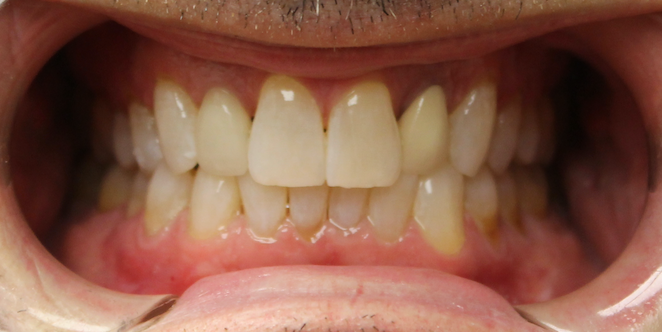 A close up of a man 's mouth with white teeth.