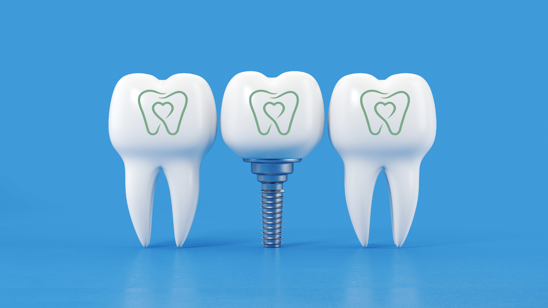 Visual Guide to Dental Implants: What Do They Really Look Like?