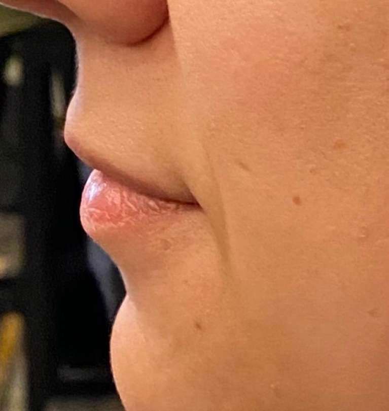 A close up of a person 's mouth and nose.