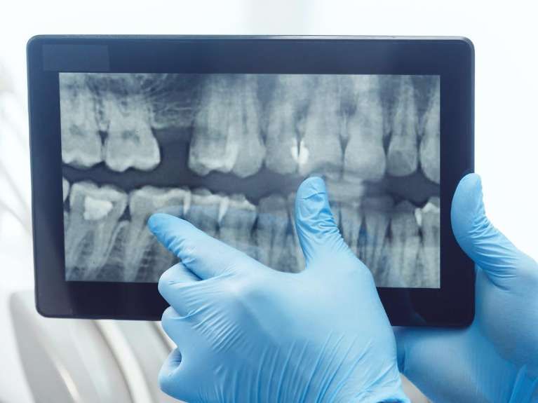 A dentist is looking at an x-ray of a patient 's teeth on a tablet.