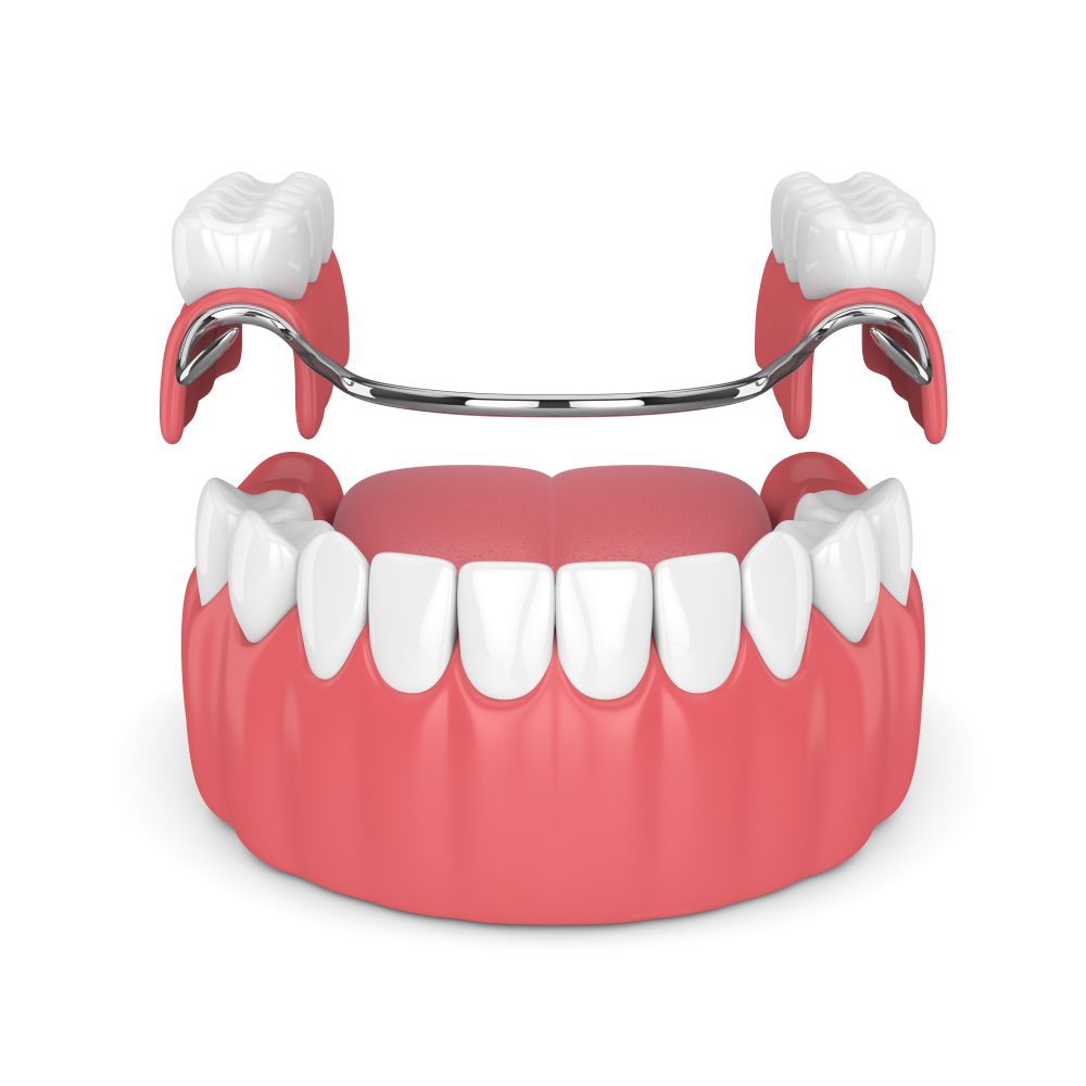 Image of a sample dentures