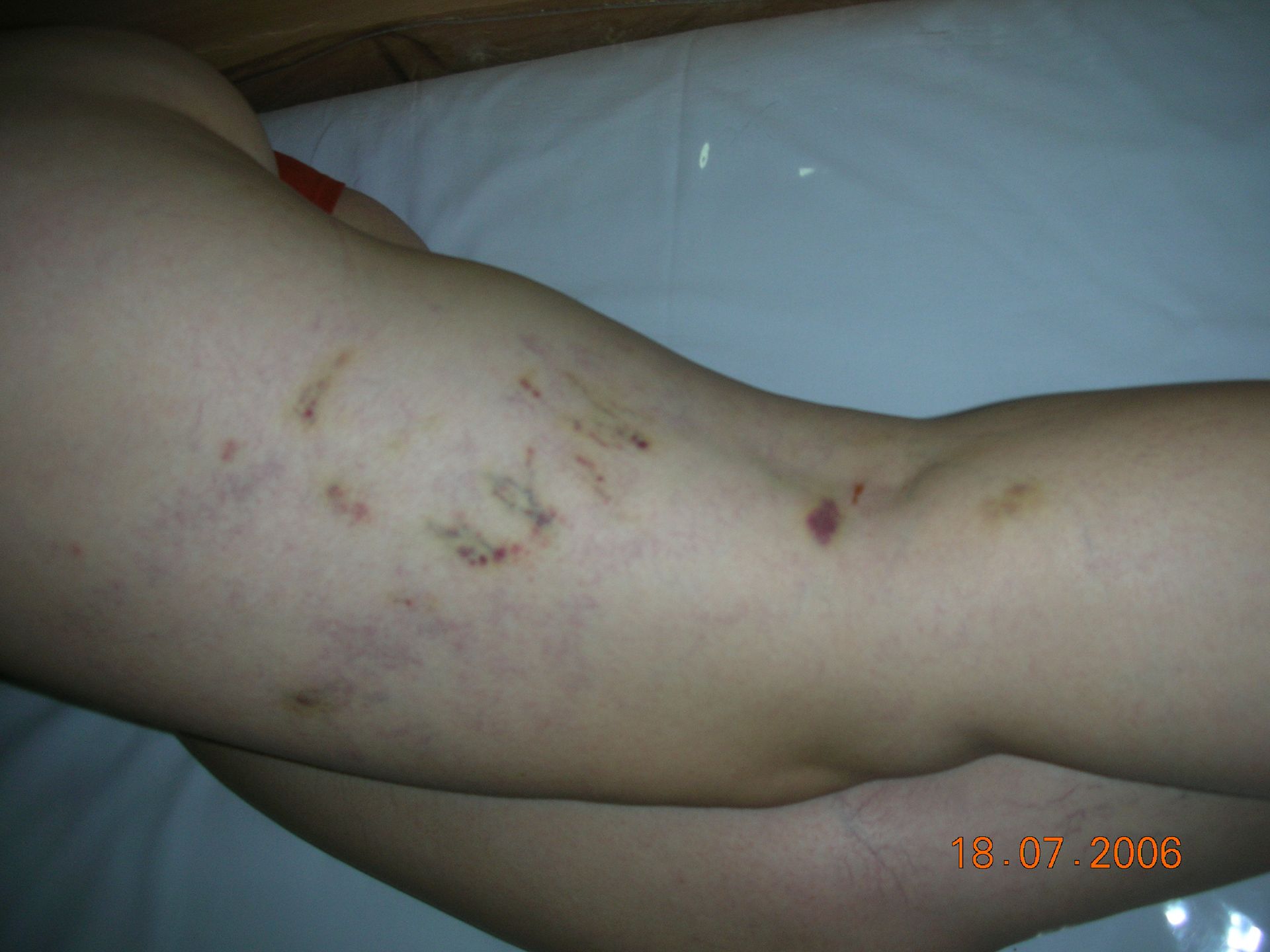 dr santiago de salas