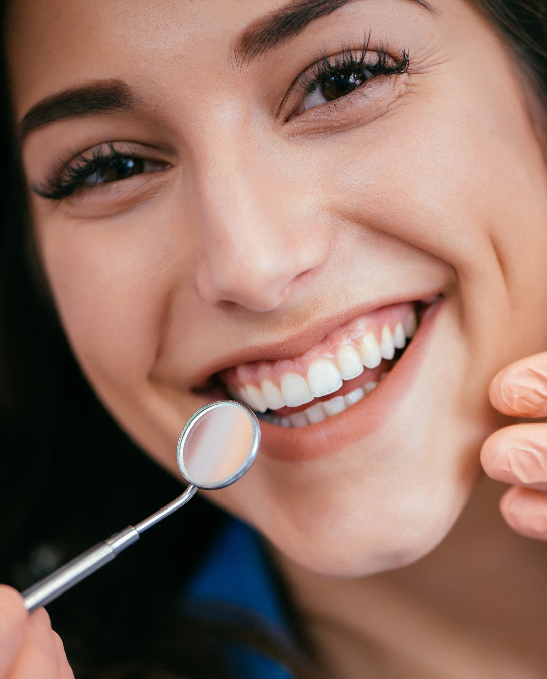 A woman is smiling while a dentist examines her teeth with a mirror.