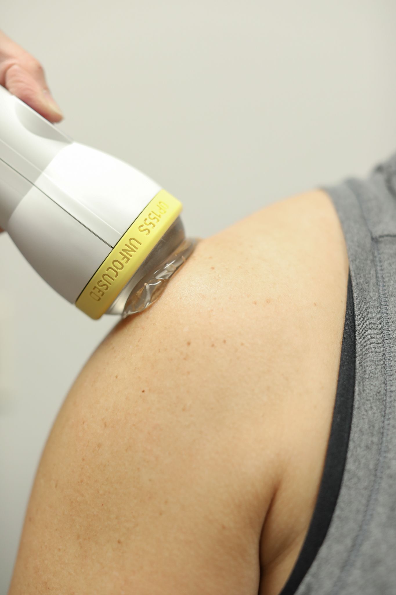 Shoulder pain treatment with SoftWave therapy.