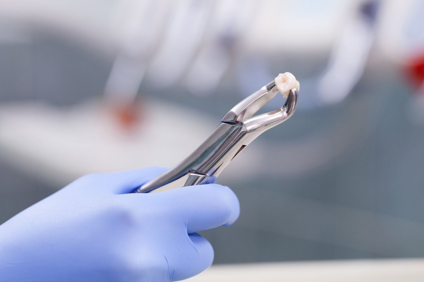 Dental Instrument For Tooth Extraction - Dental Treatments in Port Macquarie, NSW