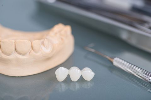 artificial teeth 