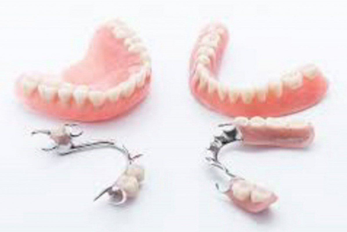 Partial Dentures, Top & Bottom — Dental Services In Sarina, QLD