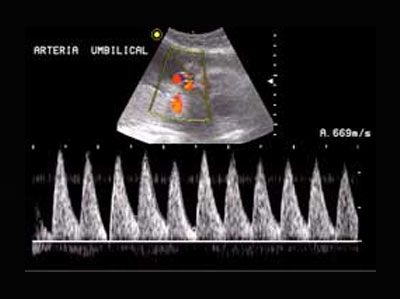 ultrasonido