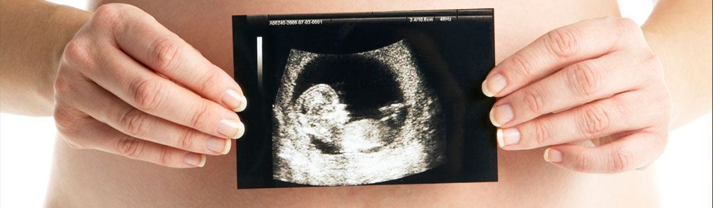 Una mujer embarazada sostiene una fotografía de su bebé en sus manos.