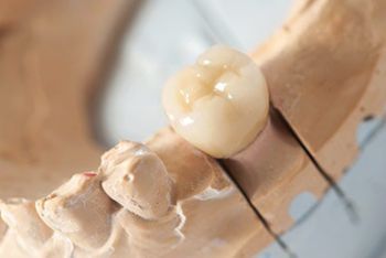 Dental Implants — Bristol, TN — McMillin & Christian Family Dentistry