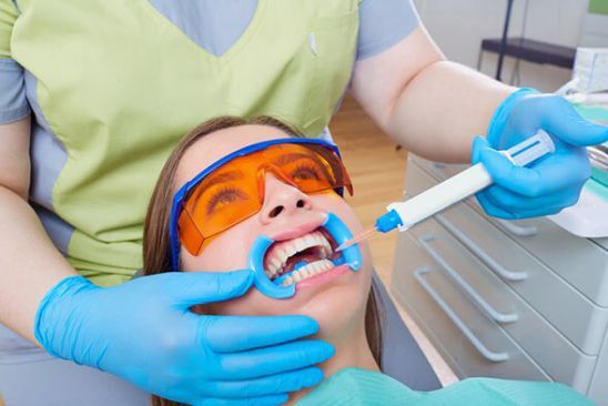 Dental Bleaching — Bristol, TN — McMillin & Christian Family Dentistry