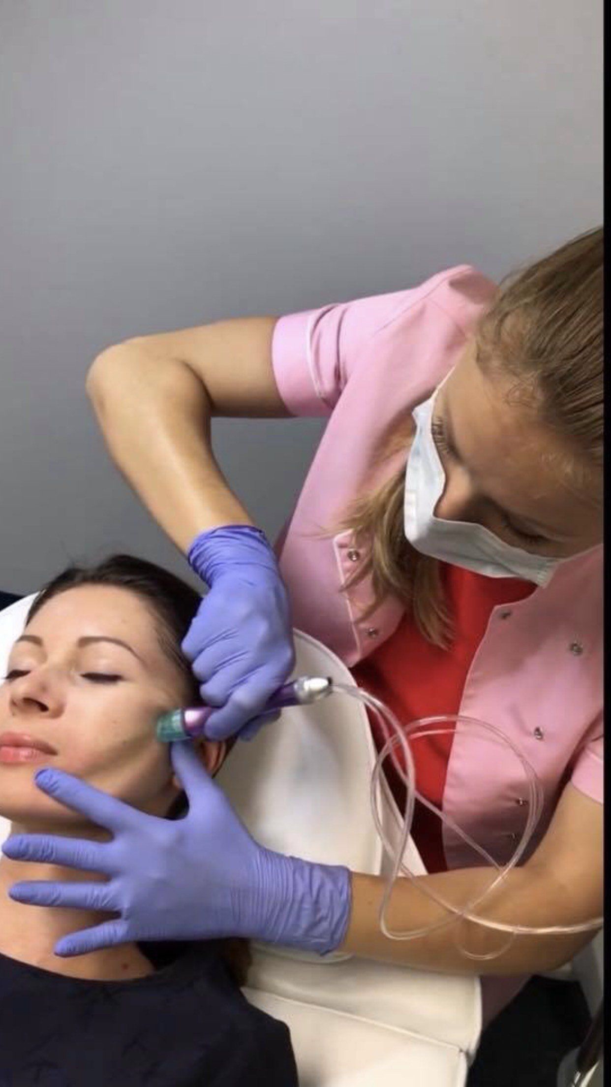 Hydradermabrasion