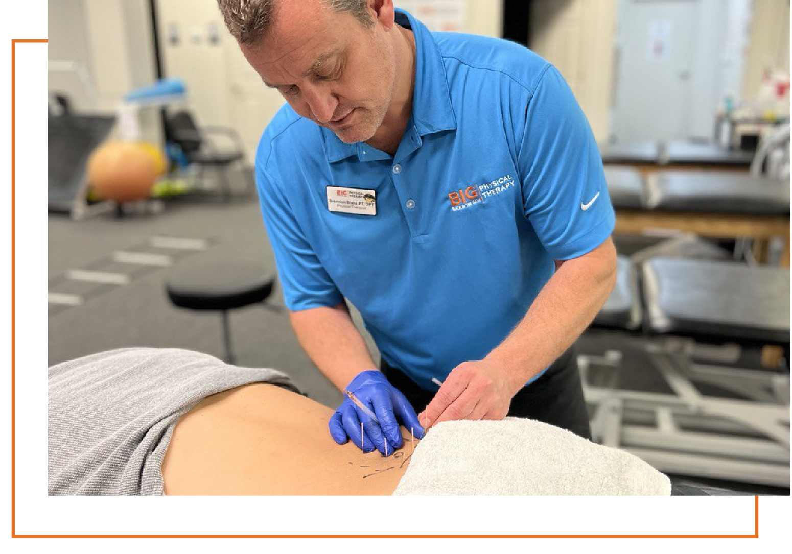 Dry Needling Therapy being provided in the Atlanta Metro Area