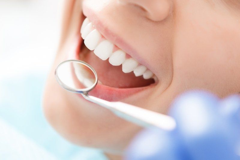 woman with white teeth