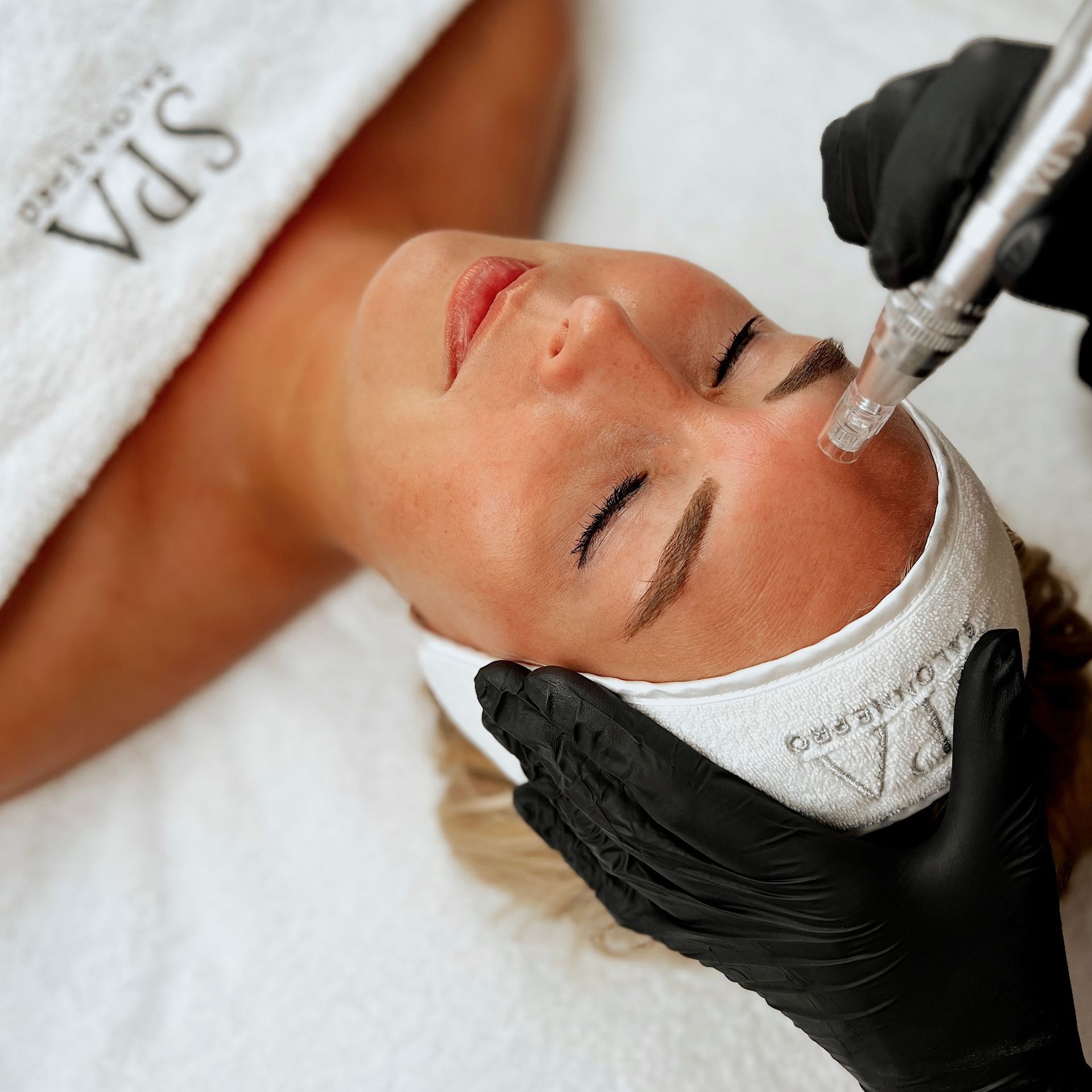 A woman is getting a microneedling treatment