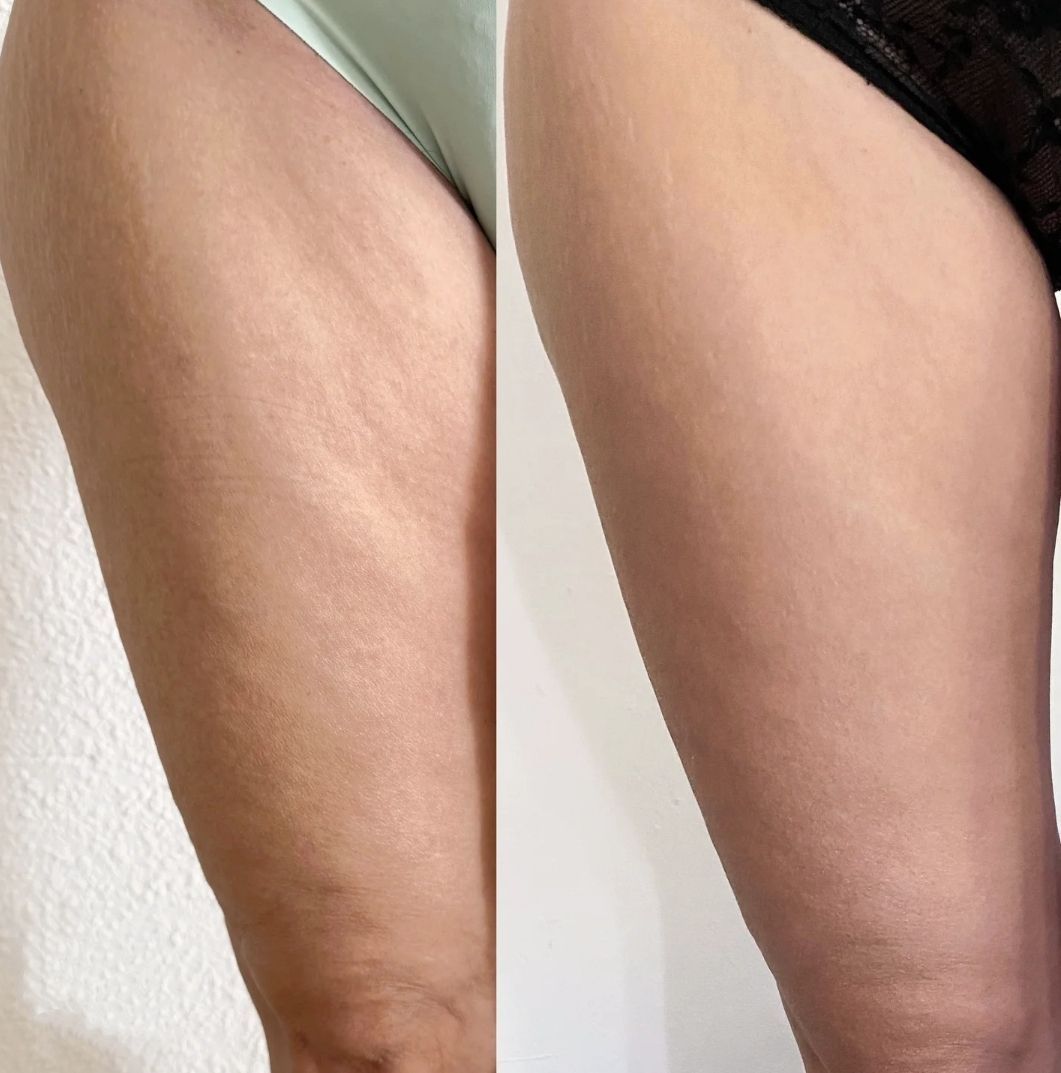 Spa Salonnepro - Body Sculpting Cream