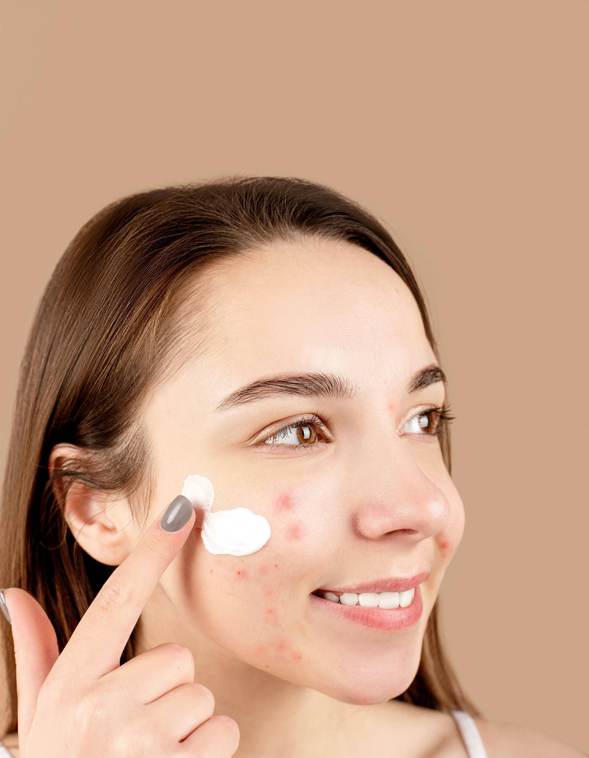 A woman is applying cream to her scars on her face.