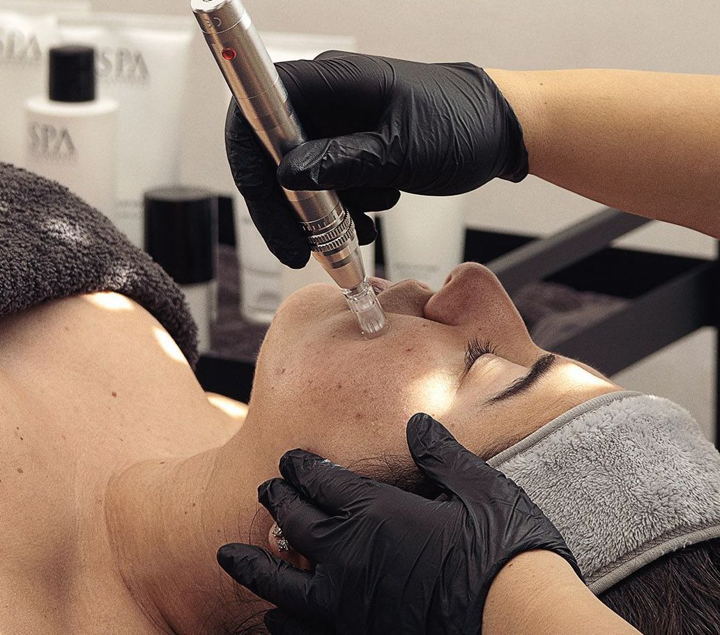 Een professional met zwarte handschoenen gebruikt een cosmetisch huidvernieuwingsapparaat op het gezicht van een cliënt tijdens een behandeling.