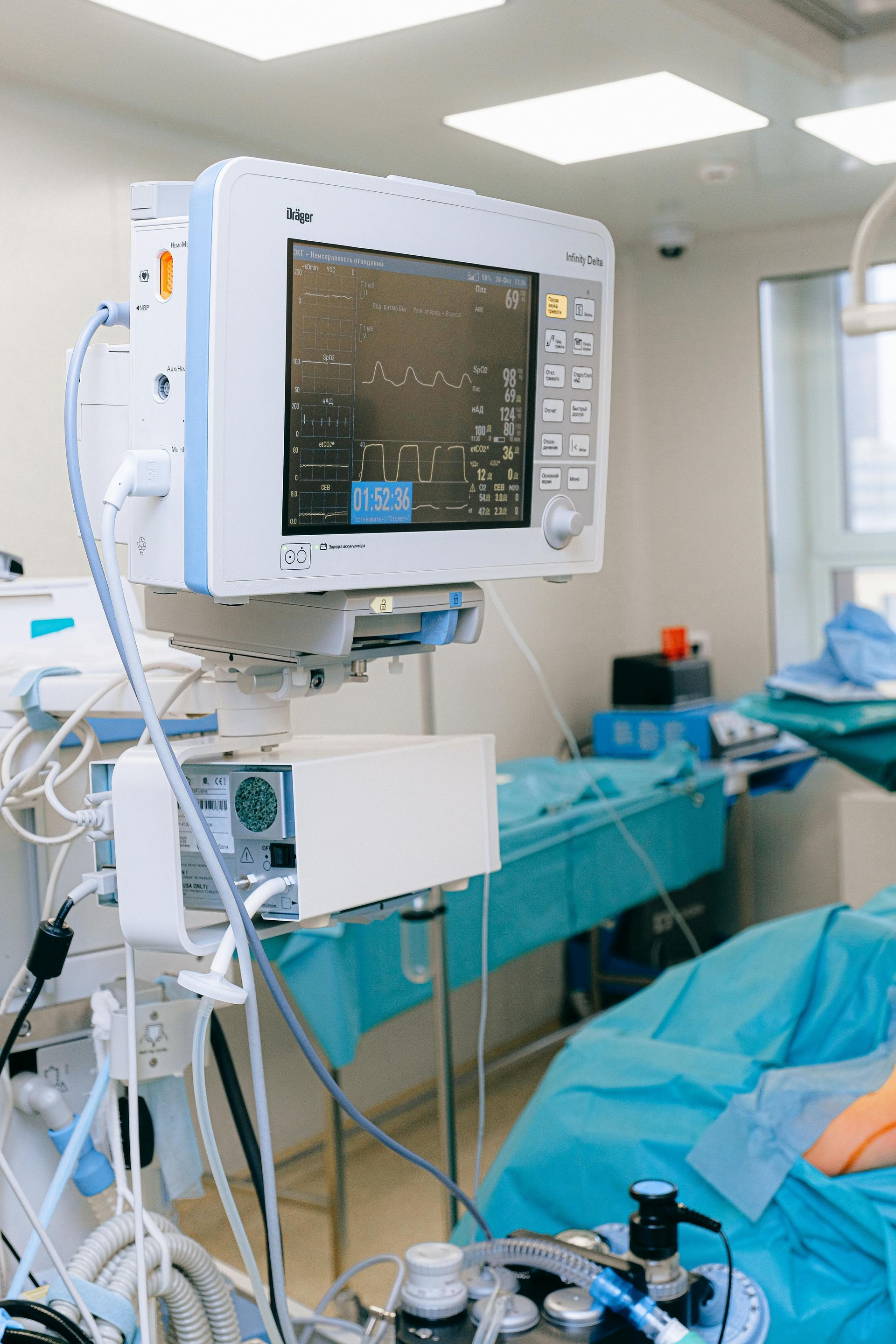 Medical monitoring equipment in an operating room with a bed covered in blue sheets and a window.