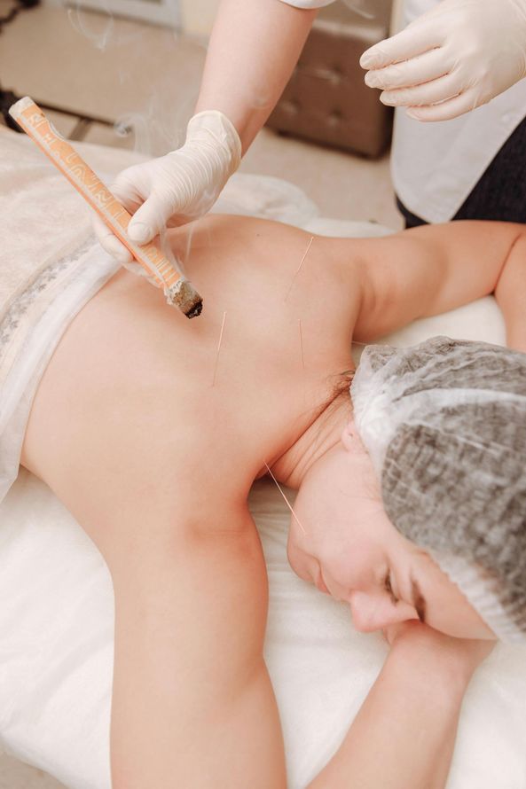 Best acupuncture services in Westminster, MD. Woman getting acupuncture services from our top acupuncture Chinese medicine doctor in Westminster, MD.