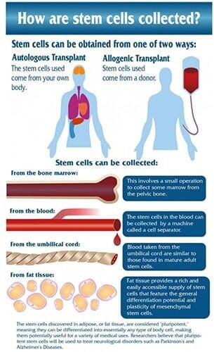 Stem Cell Brochure3 - Orthopedic Care in Albuquerque, NM