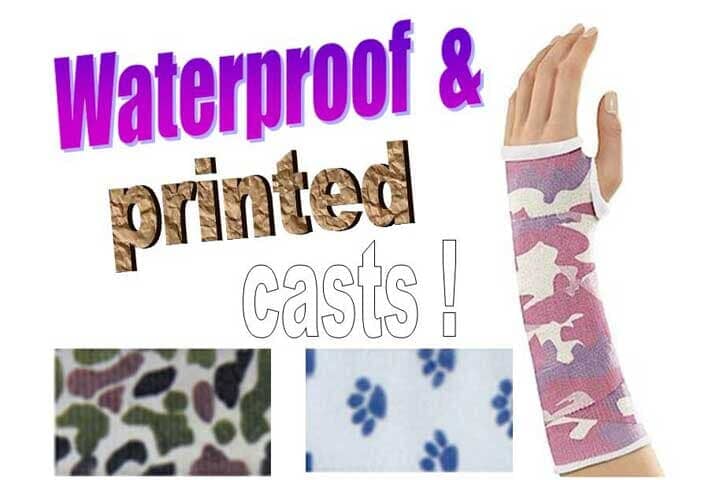 Waterproof and printed casts - Orthopedic Care Center in Albuquerque, NM