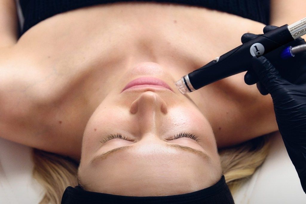 Woman receiving facial microneedling treatment, eyes closed. Black-gloved hand using device on face.