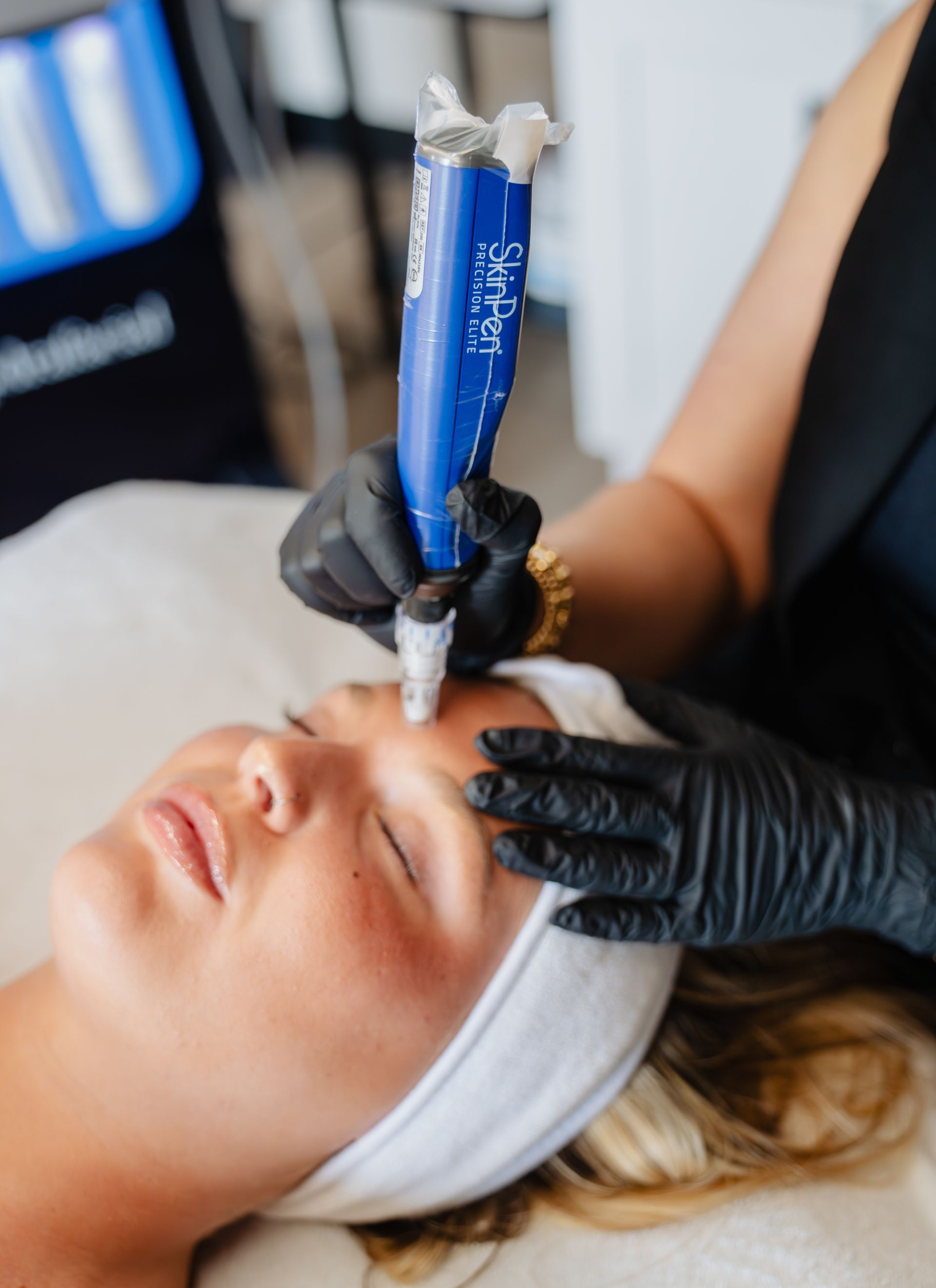 A woman receiving micro-needling treatment on her face. Doctor in blue gloves holds device.