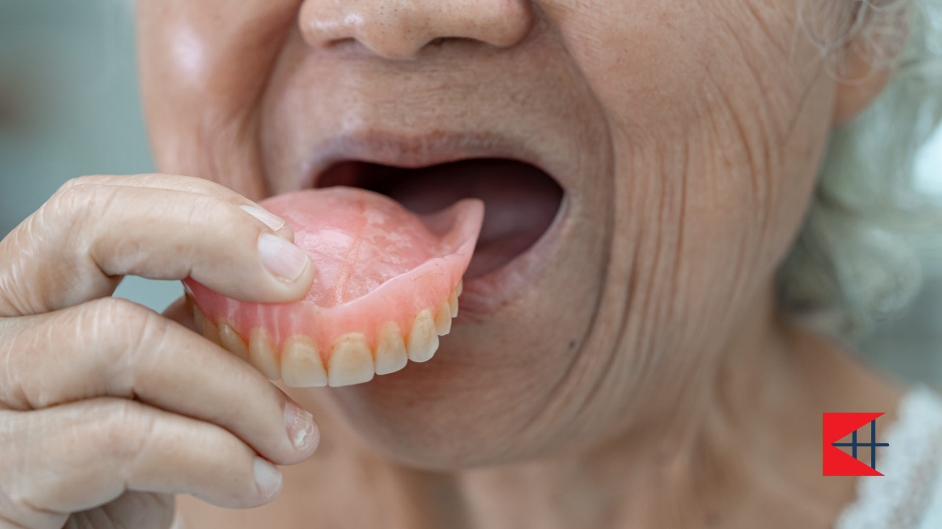 An elderly woman is holding a denture in her mouth.