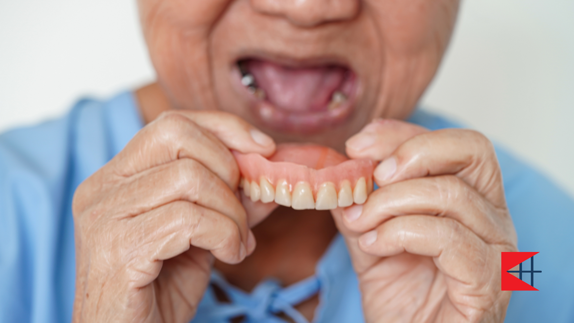 An elderly woman is holding her dentures in her hands.