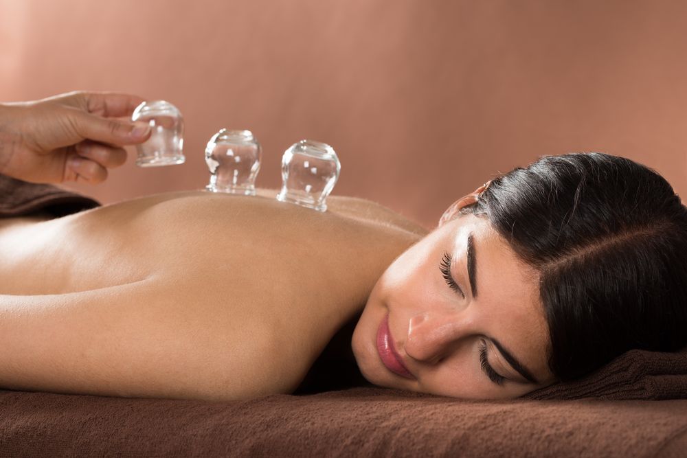 Person Receiving Cupping Therapy on Their Back — A1 Coffs Harbour in Coffs Harbour, NSW
