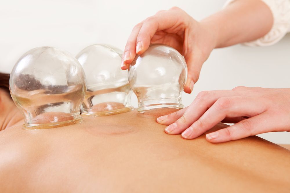 Person Receiving Cupping Therapy on Their Back — A1 Coffs Harbour in Coffs Harbour, NSW