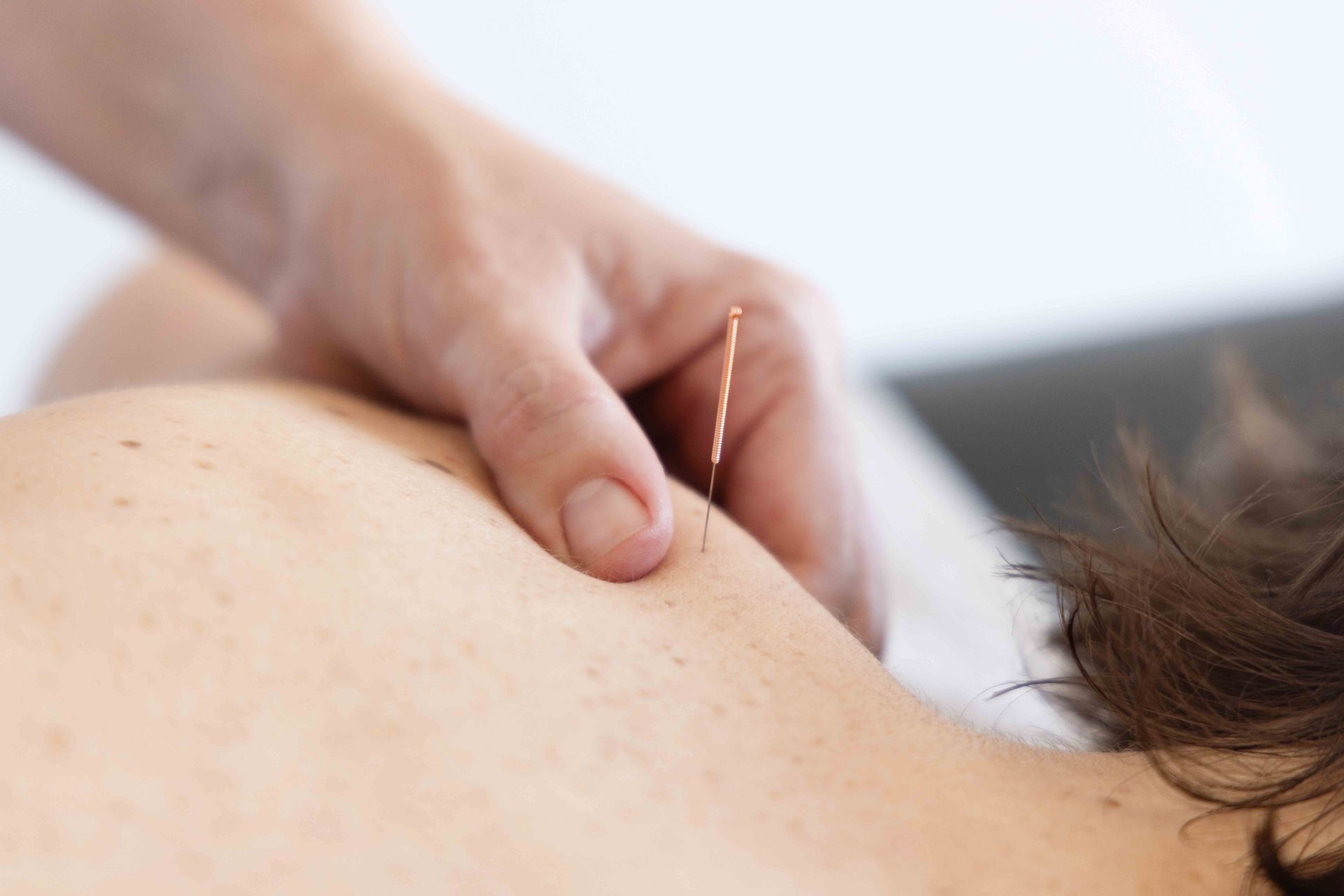 Professional Performing Dry Needling