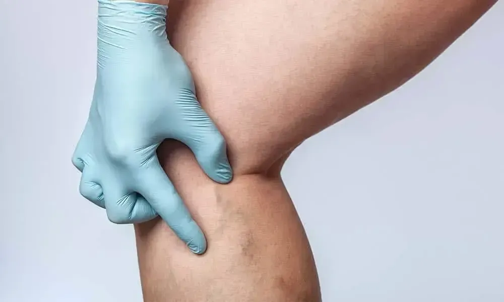 A person wearing gloves is touching their knee.