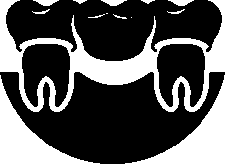 Bridges and Crowns Icon | Family Dentist Osborne KS